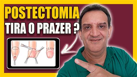 postectomia o que é - coisas que só tem no brasil